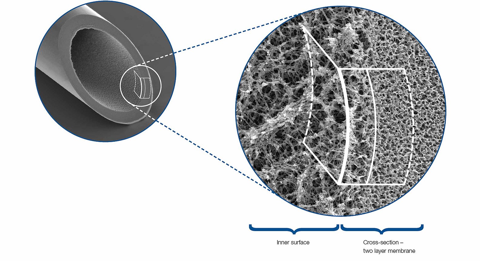 Plazmafilterek elektronmikroszkópos felvétele