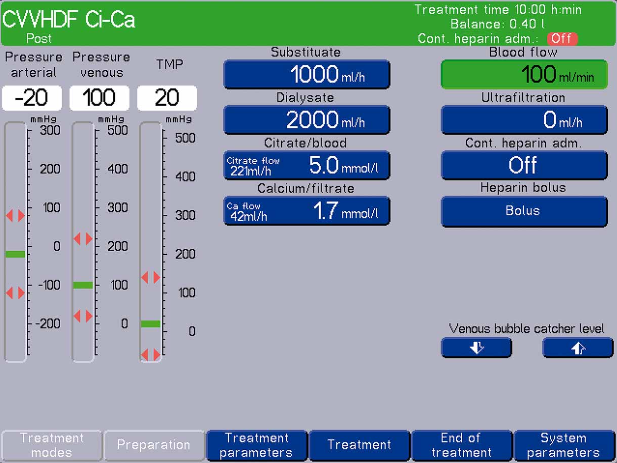 A multiFiltrate Ci-Ca® poszt-CVVHDF sztenderd beállításai